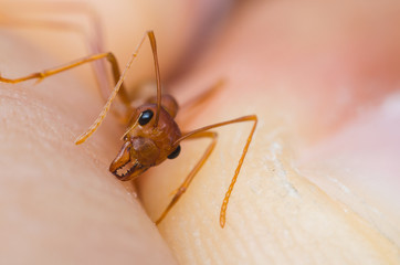 red ant biting human hand skin.