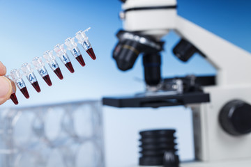 Microscope Subject Table and Biological Samples. Microscope is the main research tool in many scientific microbiology laboratories