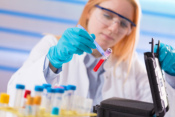 Female laboratory assistant with blood test for AIDS