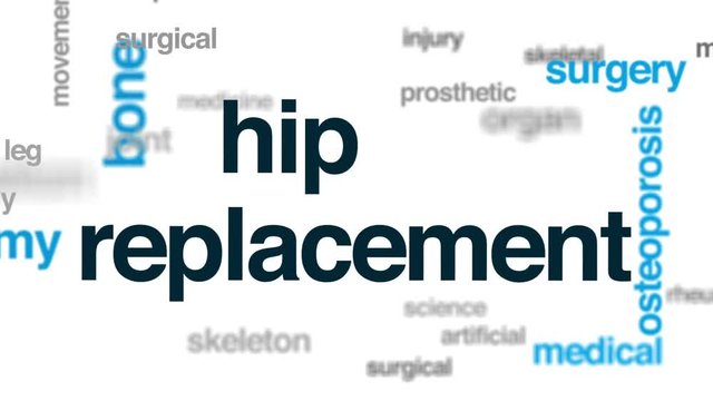 Hip replacement animated word cloud, text design animation.