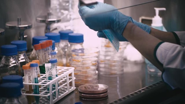 technician with loop and petri dish in the laboratory / hand of Doctor making a urine culture in a petri dish