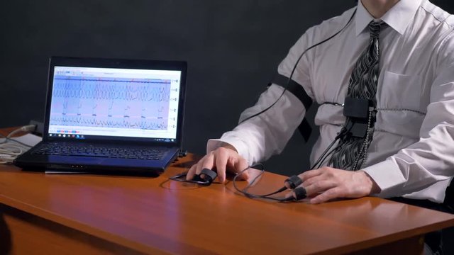 Polygraph subject hands lying calmly beside a laptop.