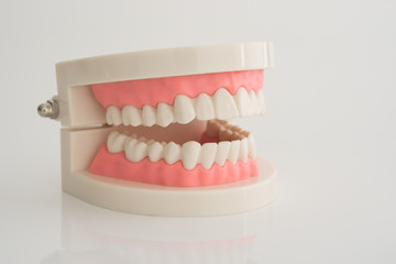 Artificial dental model