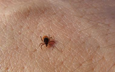 tick Ixodes sitting on the human skin