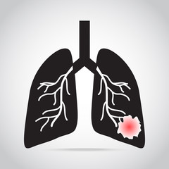 lung cancer  icon, medical concept illustration