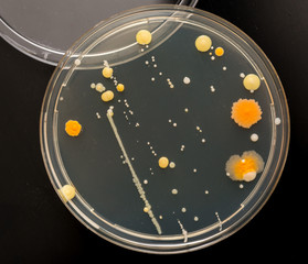 A petri dish with growing cultures of microorganisms, fungi and microbes.