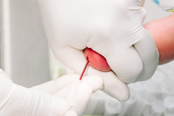 Pricking baby foot blood test