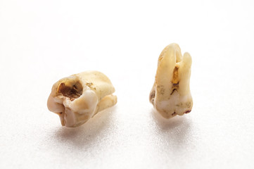 Two bad teeth - Oral dental hygiene