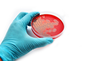 Colonies of bacteria in petri dish (blood agar)
