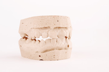 Gypsum model human jaws prothetic laboratory. Dental casting