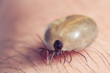 Tick filled with blood sitting on human skin