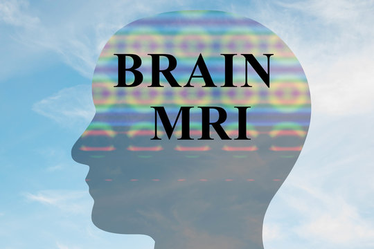 Brain MRI - mental concept