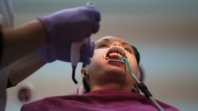 Installing the brackets on the teeth of a young female