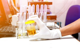 Urine sample