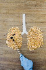 Doctor performing surgery on human lungs concept. Surgeon operating lung cancer tumor. Hand holding forceps. Cancer awareness. Lungs made of dry yellow peas. Air pollution smoking concept