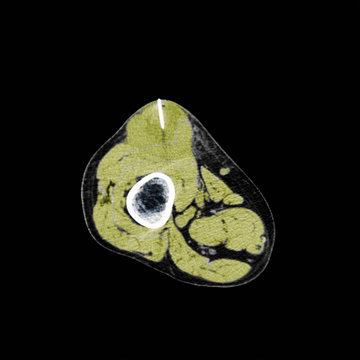 Close up of x-ray