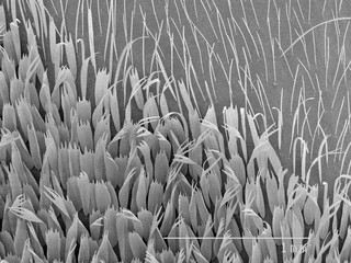 Magnified view of hairs on moth wing