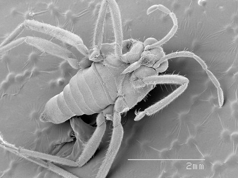 Magnified view of water strider