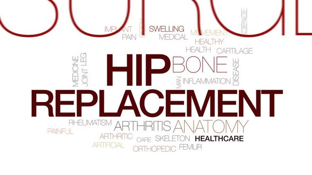 Hip replacement animated word cloud, text design animation. Kinetic typography.