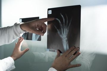 Examining hand x ray