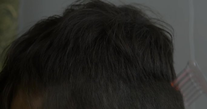 Medical procedure darsonvalization close-up. Child uses darsonval for massage head's skin. Receiving electric darsonval facial massage procedure.