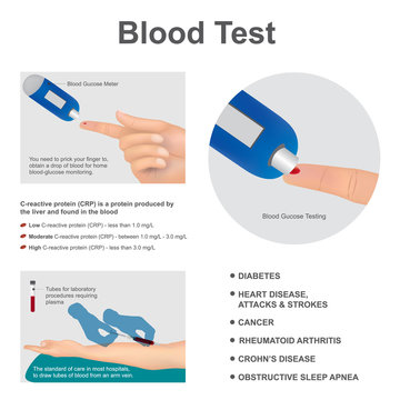 Blood test laboratory analysis. Illustration graphic vector.