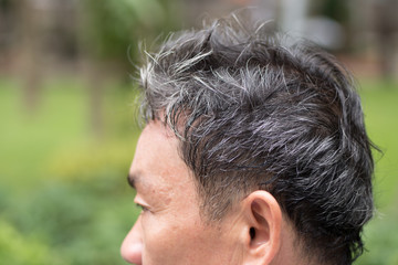 Obraz premium old senior or middle aged man with grey hair problem