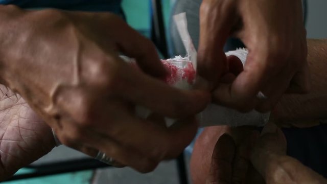 Remove the bandage from the arm wound