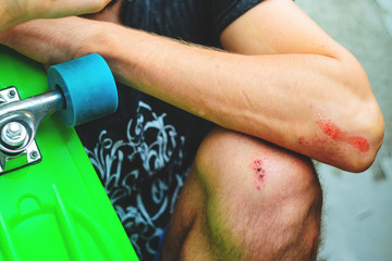 Injuries in extreme sports © v_sot