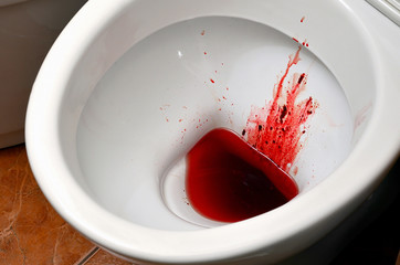 A white ceramic toilet bowl is stained with blood. The consequences of pronounced menstruation,...