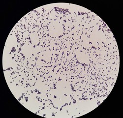 Smear of gram positive cocci bacteria under 100X light microscope.