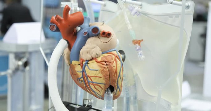Artificial circulation of blood, man's artificial heart, model of the heart. Donor heart