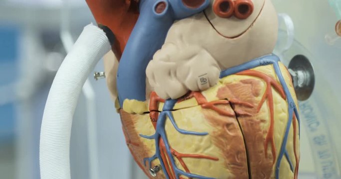 Artificial circulation of blood, man's artificial heart, model of the heart. Donor heart