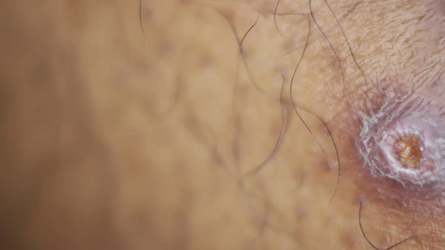 Close up of Human Skin Texture 
