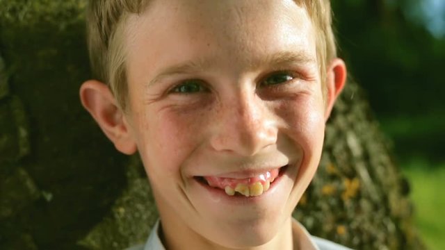 A beautiful guy with bad teeth laughing. Close-up