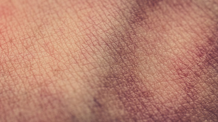closeup of human skin, bruises, veins, skin texture - 162050793