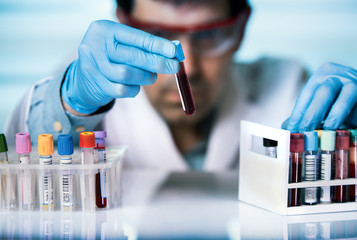hand of doctor holding blood sample in tube test for analysis in laboratory / technician of health...