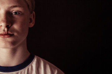 Obraz premium Cropped front view on boy with bloody nose