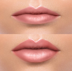 Fototapeta premium Comparison of female lips after augmentation