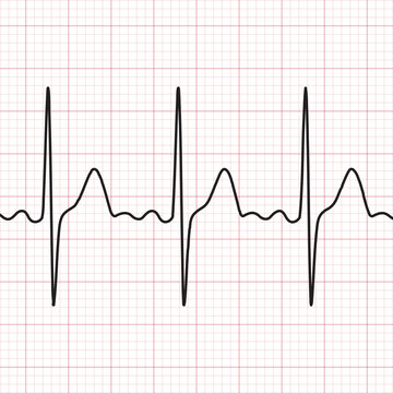 Cardiogram. Electrocardiogram. Graphic representation of heart work . Health and medicine.