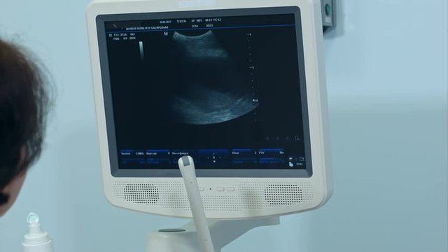 Female gynecologist checking fetal life with ultrasound scanner