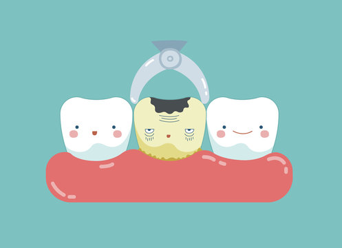 To take decayed tooth out ,teeth and tooth concept of dental 