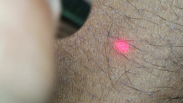 Close up of Human Skin Texture 
