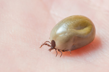 Tick filled with blood sitting on human skin