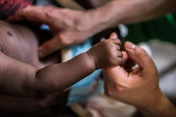 Deurstickers Handen helpen bij een medische missie in Afrika © Zsolt Repasy