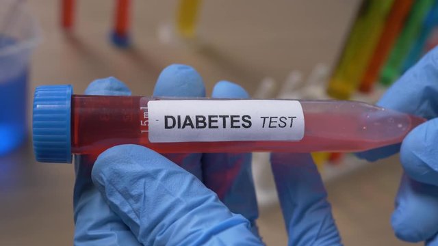 Scientist holding a Diabetes test tube filled with a red substance. Filmed in a lab environment. Closeup on the tube.
