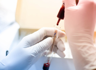 hand holding blood sample