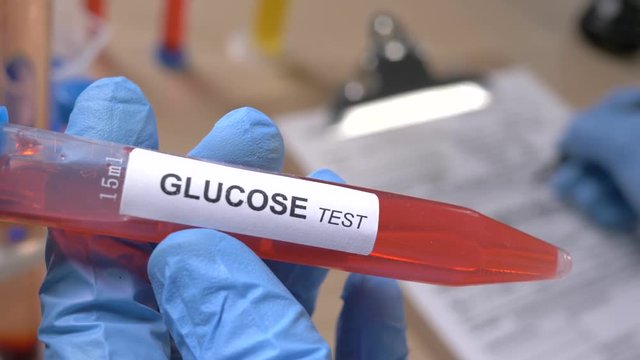 Scientist holding a Glucose test tube while taking some notes observations in a notebook. Filmed in a lab environment. Closeup on the tube.