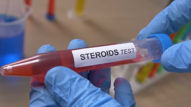 Scientist holding a steroids test tube while taking some notes observations in a notebook. Filmed in a lab environment. Closeup on the tube.