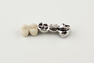 Bridged dental prostheses